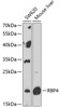 Western blot analysis of extracts of various cell lines, using RBP4 Antibody (14-460) at 1:1000 dilution.<br/>Secondary antibody: HRP Goat Anti-Rabbit IgG (H+L) at 1:10000 dilution.<br/>Lysates/proteins: 25ug per lane.<br/>Blocking buffer: 3% nonfat dry milk in TBST.