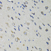 Immunohistochemistry of paraffin-embedded rat brain using RBP4 antibody (14-460) at dilution of 1:100 (40x lens) .