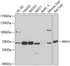 Western blot analysis of extracts of various cell lines, using RPN1 antibody (14-462) at 1:1000 dilution.<br/>Secondary antibody: HRP Goat Anti-Rabbit IgG (H+L) at 1:10000 dilution.<br/>Lysates/proteins: 25ug per lane.<br/>Blocking buffer: 3% nonfat dry milk in TBST.<br/>Detection: ECL Basic Kit.<br/>Exposure time: 90s.