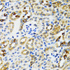 Immunohistochemistry of paraffin-embedded rat kidney using RPN1 antibody (14-462) at dilution of 1:100 (40x lens) .