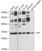 Western blot analysis of extracts of various cell lines, using SET antibody (14-466) at 1:1000 dilution.<br/>Secondary antibody: HRP Goat Anti-Rabbit IgG (H+L) at 1:10000 dilution.<br/>Lysates/proteins: 25ug per lane.<br/>Blocking buffer: 3% nonfat dry milk in TBST.<br/>Detection: ECL Basic Kit.<br/>Exposure time: 30s.