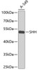 Western blot analysis of extracts of A-549 cells, using SHH antibody (14-467) at 1:1000 dilution.<br/>Secondary antibody: HRP Goat Anti-Rabbit IgG (H+L) at 1:10000 dilution.<br/>Lysates/proteins: 25ug per lane.<br/>Blocking buffer: 3% nonfat dry milk in TBST.<br/>Detection: ECL Basic Kit.<br/>Exposure time: 90s.