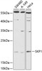 Western blot analysis of extracts of various cell lines, using SKP1 antibody (14-468) at 1:1000 dilution.<br/>Secondary antibody: HRP Goat Anti-Rabbit IgG (H+L) at 1:10000 dilution.<br/>Lysates/proteins: 25ug per lane.<br/>Blocking buffer: 3% nonfat dry milk in TBST.