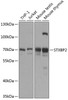 Western blot analysis of extracts of various cell lines, using STXBP2 antibody (14-472) at 1:1000 dilution.<br/>Secondary antibody: HRP Goat Anti-Rabbit IgG (H+L) at 1:10000 dilution.<br/>Lysates/proteins: 25ug per lane.<br/>Blocking buffer: 3% nonfat dry milk in TBST.<br/>Detection: ECL Basic Kit.<br/>Exposure time: 90s.