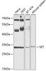 Western blot analysis of extracts of various cell lines, using SET antibody (14-474) at 1:1000 dilution.<br/>Secondary antibody: HRP Goat Anti-Rabbit IgG (H+L) at 1:10000 dilution.<br/>Lysates/proteins: 25ug per lane.<br/>Blocking buffer: 3% nonfat dry milk in TBST.<br/>Detection: ECL Basic Kit.<br/>Exposure time: 60s.