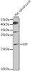 Western blot analysis of extracts of rat spinal cord, using VIP antibody (14-487) at 1:1000 dilution.<br/>Secondary antibody: HRP Goat Anti-Rabbit IgG (H+L) at 1:10000 dilution.<br/>Lysates/proteins: 25ug per lane.<br/>Blocking buffer: 3% nonfat dry milk in TBST.<br/>Detection: ECL Enhanced Kit.<br/>Exposure time: 90s.
