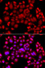 Immunofluorescence analysis of A549 cells using PIP4K2B antibody (14-489) . Blue: DAPI for nuclear staining.