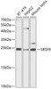 Western blot analysis of extracts of various cell lines, using SRSF9 antibody (14-491) at 1:1000 dilution.<br/>Secondary antibody: HRP Goat Anti-Rabbit IgG (H+L) at 1:10000 dilution.<br/>Lysates/proteins: 25ug per lane.<br/>Blocking buffer: 3% nonfat dry milk in TBST.<br/>Detection: ECL Basic Kit.<br/>Exposure time: 30s.