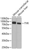 Western blot analysis of extracts of various cell lines, using TYR antibody (14-493) at 1:1000 dilution.<br/>Secondary antibody: HRP Goat Anti-Rabbit IgG (H+L) at 1:10000 dilution.<br/>Lysates/proteins: 25ug per lane.<br/>Blocking buffer: 3% nonfat dry milk in TBST.