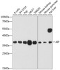 Western blot analysis of extracts of various cell lines, using AIP antibody (14-498) at 1:1000 dilution.<br/>Secondary antibody: HRP Goat Anti-Rabbit IgG (H+L) at 1:10000 dilution.<br/>Lysates/proteins: 25ug per lane.<br/>Blocking buffer: 3% nonfat dry milk in TBST.<br/>Detection: ECL Enhanced Kit.<br/>Exposure time: 90s.