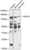 Western blot analysis of extracts of various cell lines, using HDAC4 antibody (14-502) at 1:1000 dilution.<br/>Secondary antibody: HRP Goat Anti-Rabbit IgG (H+L) at 1:10000 dilution.<br/>Lysates/proteins: 25ug per lane.<br/>Blocking buffer: 3% nonfat dry milk in TBST.<br/>Detection: ECL Basic Kit.<br/>Exposure time: 30s.