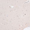 Immunohistochemistry of paraffin-embedded rat brain using ABCF2 antibody (14-504) at dilution of 1:100 (40x lens) .