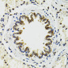 Immunohistochemistry of paraffin-embedded rat lung using RUVBL2 antibody (14-511) at dilution of 1:100 (40x lens) .