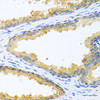 Immunohistochemistry of paraffin-embedded human prostate using KLK11 antibody (14-512) at dilution of 1:100 (40x lens) .