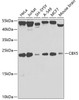 Western blot analysis of extracts of various cell lines, using CBX5 antibody (14-520) at 1:1000 dilution.<br/>Secondary antibody: HRP Goat Anti-Rabbit IgG (H+L) at 1:10000 dilution.<br/>Lysates/proteins: 25ug per lane.<br/>Blocking buffer: 3% nonfat dry milk in TBST.<br/>Detection: ECL Basic Kit.<br/>Exposure time: 30s.