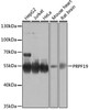 Western blot analysis of extracts of various cell lines, using PRPF19 antibody (14-527) at 1:1000 dilution.<br/>Secondary antibody: HRP Goat Anti-Rabbit IgG (H+L) at 1:10000 dilution.<br/>Lysates/proteins: 25ug per lane.<br/>Blocking buffer: 3% nonfat dry milk in TBST.<br/>Detection: ECL Basic Kit.<br/>Exposure time: 30s.