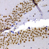 Immunohistochemistry of paraffin-embedded rat hippocampus using CBX5 antibody (14-529) at dilution of 1:100 (40x lens) .