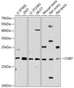 Western blot analysis of extracts of various cell lines, using CGB7 Antibody (14-536) at 1:1000 dilution.<br/>Secondary antibody: HRP Goat Anti-Rabbit IgG (H+L) at 1:10000 dilution.<br/>Lysates/proteins: 25ug per lane.<br/>Blocking buffer: 3% nonfat dry milk in TBST.<br/>Detection: ECL Basic Kit.<br/>Exposure time: 90s.