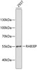 Western blot analysis of extracts of 293T cells, using RAB3IP antibody (14-538) at 1:1000 dilution.<br/>Secondary antibody: HRP Goat Anti-Rabbit IgG (H+L) at 1:10000 dilution.<br/>Lysates/proteins: 25ug per lane.<br/>Blocking buffer: 3% nonfat dry milk in TBST.<br/>Detection: ECL Enhanced Kit.<br/>Exposure time: 60s.