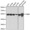 Western blot analysis of extracts of various cell lines, using TUBB8 antibody (14-544) at 1:1000 dilution.<br/>Secondary antibody: HRP Goat Anti-Rabbit IgG (H+L) at 1:10000 dilution.<br/>Lysates/proteins: 25ug per lane.<br/>Blocking buffer: 3% nonfat dry milk in TBST.<br/>Detection: ECL Basic Kit.<br/>Exposure time: 1s.
