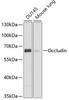 Western blot analysis of extracts of various cell lines, using Occludin antibody (14-548) at 1:1000 dilution.<br/>Secondary antibody: HRP Goat Anti-Rabbit IgG (H+L) at 1:10000 dilution.<br/>Lysates/proteins: 25ug per lane.<br/>Blocking buffer: 3% nonfat dry milk in TBST.<br/>Detection: ECL Basic Kit.<br/>Exposure time: 15s.