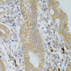 Immunohistochemistry of paraffin-embedded human stomach using Occludin antibody (14-548) at dilution of 1:100 (40x lens) .