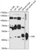 Western blot analysis of extracts of various cell lines, using CKB antibody (14-552) at 1:3000 dilution.<br/>Secondary antibody: HRP Goat Anti-Rabbit IgG (H+L) at 1:10000 dilution.<br/>Lysates/proteins: 25ug per lane.<br/>Blocking buffer: 3% nonfat dry milk in TBST.<br/>Detection: ECL Basic Kit.<br/>Exposure time: 60s.