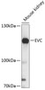 Western blot analysis of extracts of mouse kidney, using EVC antibody (14-553) at 1:3000 dilution.<br/>Secondary antibody: HRP Goat Anti-Rabbit IgG (H+L) at 1:10000 dilution.<br/>Lysates/proteins: 25ug per lane.<br/>Blocking buffer: 3% nonfat dry milk in TBST.<br/>Detection: ECL Basic Kit.<br/>Exposure time: 10s.