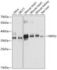 Western blot analysis of extracts of various cell lines, using PRPS2 antibody (14-557) at 1:3000 dilution.<br/>Secondary antibody: HRP Goat Anti-Rabbit IgG (H+L) at 1:10000 dilution.<br/>Lysates/proteins: 25ug per lane.<br/>Blocking buffer: 3% nonfat dry milk in TBST.<br/>Detection: ECL Basic Kit.<br/>Exposure time: 30s.