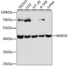 Western blot analysis of extracts of various cell lines, using WWOX antibody (14-562) at 1:3000 dilution.<br/>Secondary antibody: HRP Goat Anti-Rabbit IgG (H+L) at 1:10000 dilution.<br/>Lysates/proteins: 25ug per lane.<br/>Blocking buffer: 3% nonfat dry milk in TBST.<br/>Detection: ECL Basic Kit.<br/>Exposure time: 10s.