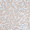 Immunohistochemistry of paraffin-embedded human liver using ACADL antibody (14-568) at dilution of 1:100 (40x lens) .