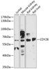 Western blot analysis of extracts of various cell lines, using CDY2B antibody (14-571) at 1:3000 dilution.<br/>Secondary antibody: HRP Goat Anti-Rabbit IgG (H+L) at 1:10000 dilution.<br/>Lysates/proteins: 25ug per lane.<br/>Blocking buffer: 3% nonfat dry milk in TBST.<br/>Detection: ECL Basic Kit.<br/>Exposure time: 30s.