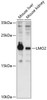Western blot analysis of extracts of various cell lines, using LMO2 antibody (14-575) at 1:3000 dilution.<br/>Secondary antibody: HRP Goat Anti-Rabbit IgG (H+L) at 1:10000 dilution.<br/>Lysates/proteins: 25ug per lane.<br/>Blocking buffer: 3% nonfat dry milk in TBST.<br/>Detection: ECL Enhanced Kit.<br/>Exposure time: 90s.