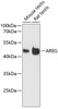 Western blot analysis of extracts of various cell lines, using AREG antibody (14-577) at 1:3000 dilution.<br/>Secondary antibody: HRP Goat Anti-Rabbit IgG (H+L) at 1:10000 dilution.<br/>Lysates/proteins: 25ug per lane.<br/>Blocking buffer: 3% nonfat dry milk in TBST.<br/>Detection: ECL Basic Kit.<br/>Exposure time: 90s.