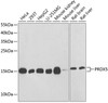 Western blot analysis of extracts of various cell lines, using PRDX5 antibody (14-582) at 1:1000 dilution.<br/>Secondary antibody: HRP Goat Anti-Rabbit IgG (H+L) at 1:10000 dilution.<br/>Lysates/proteins: 25ug per lane.<br/>Blocking buffer: 3% nonfat dry milk in TBST.<br/>Detection: ECL Basic Kit.<br/>Exposure time: 90s.