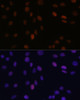Immunofluorescence analysis of C6 cells using PSME3 Polyclonal Antibody (14-585) at dilution of 1:100 (40x lens) . Blue: DAPI for nuclear staining.