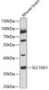 Western blot analysis of extracts of mouse brain, using SLC10A1 antibody (14-599) at 1:3000 dilution.<br/>Secondary antibody: HRP Goat Anti-Rabbit IgG (H+L) at 1:10000 dilution.<br/>Lysates/proteins: 25ug per lane.<br/>Blocking buffer: 3% nonfat dry milk in TBST.<br/>Detection: ECL Enhanced Kit.<br/>Exposure time: 90s.