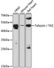 Western blot analysis of extracts of various cell lines, using Tafazzin / TAZ antibody (14-600) at 1:3000 dilution.<br/>Secondary antibody: HRP Goat Anti-Rabbit IgG (H+L) at 1:10000 dilution.<br/>Lysates/proteins: 25ug per lane.<br/>Blocking buffer: 3% nonfat dry milk in TBST.<br/>Detection: ECL Basic Kit.<br/>Exposure time: 40s.