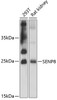 Western blot analysis of extracts of various cell lines, using SENP8 antibody (14-613) at 1:3000 dilution.<br/>Secondary antibody: HRP Goat Anti-Rabbit IgG (H+L) at 1:10000 dilution.<br/>Lysates/proteins: 25ug per lane.<br/>Blocking buffer: 3% nonfat dry milk in TBST.<br/>Detection: ECL Enhanced Kit.<br/>Exposure time: 30s.