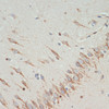 Immunohistochemistry of paraffin-embedded rat brain using TH antibody (14-615) at dilution of 1:200 (40x lens) .