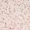 Immunohistochemistry of paraffin-embedded mouse brain using TH antibody (14-615) at dilution of 1:200 (40x lens) .