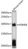 Western blot analysis of extracts of mouse brain, using KDM6B antibody (14-618) at 1:1000 dilution.<br/>Secondary antibody: HRP Goat Anti-Rabbit IgG (H+L) at 1:10000 dilution.<br/>Lysates/proteins: 25ug per lane.<br/>Blocking buffer: 3% nonfat dry milk in TBST.<br/>Detection: ECL Basic Kit.<br/>Exposure time: 10s.