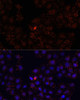 Immunofluorescence analysis of HeLa cells using WDR81 antibody (14-624) at dilution of 1:100. Blue: DAPI for nuclear staining.