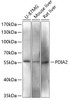 Western blot analysis of extracts of various cell lines, using PDIA2 antibody (14-628) at 1:3000 dilution.<br/>Secondary antibody: HRP Goat Anti-Rabbit IgG (H+L) at 1:10000 dilution.<br/>Lysates/proteins: 25ug per lane.<br/>Blocking buffer: 3% nonfat dry milk in TBST.<br/>Detection: ECL Basic Kit.<br/>Exposure time: 90s.