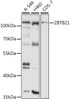 Western blot analysis of extracts of various cell lines, using ZBTB21 antibody (14-630) at 1:3000 dilution.<br/>Secondary antibody: HRP Goat Anti-Rabbit IgG (H+L) at 1:10000 dilution.<br/>Lysates/proteins: 25ug per lane.<br/>Blocking buffer: 3% nonfat dry milk in TBST.<br/>Detection: ECL Basic Kit.<br/>Exposure time: 30s.
