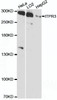Western blot analysis of extracts of various cell lines, using ITPR3 antibody (14-631) at 1:3000 dilution.<br/>Secondary antibody: HRP Goat Anti-Rabbit IgG (H+L) at 1:10000 dilution.<br/>Lysates/proteins: 25ug per lane.<br/>Blocking buffer: 3% nonfat dry milk in TBST.<br/>Detection: ECL Basic Kit.<br/>Exposure time: 90s.
