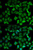 Immunofluorescence analysis of HeLa cells using NOS1 antibody (14-632) . Blue: DAPI for nuclear staining.