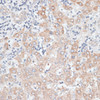 Immunohistochemistry of paraffin-embedded human liver using GPC4 antibody (14-635) at dilution of 1:100 (40x lens) .