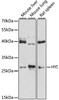 Western blot analysis of extracts of various cell lines, using HYI antibody (14-636) at 1:3000 dilution.<br/>Secondary antibody: HRP Goat Anti-Rabbit IgG (H+L) at 1:10000 dilution.<br/>Lysates/proteins: 25ug per lane.<br/>Blocking buffer: 3% nonfat dry milk in TBST.<br/>Detection: ECL Enhanced Kit.<br/>Exposure time: 90s.