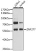 Western blot analysis of extracts of various cell lines, using ZNF277 antibody (14-647) at 1:3000 dilution.<br/>Secondary antibody: HRP Goat Anti-Rabbit IgG (H+L) at 1:10000 dilution.<br/>Lysates/proteins: 25ug per lane.<br/>Blocking buffer: 3% nonfat dry milk in TBST.<br/>Detection: ECL Basic Kit.<br/>Exposure time: 10s.